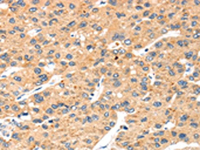 SLC8B1 Antibody