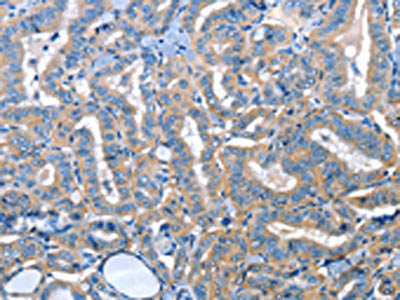 ADH4 Antibody