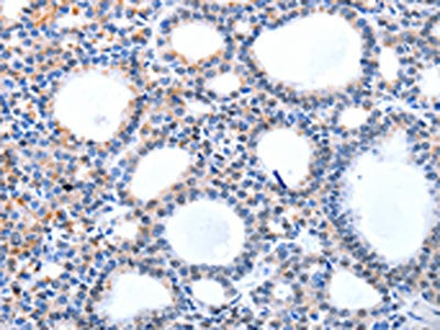 HCN1 Antibody