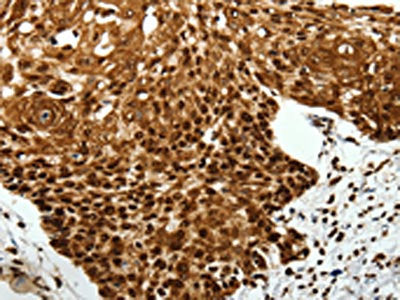 SCN1A Antibody
