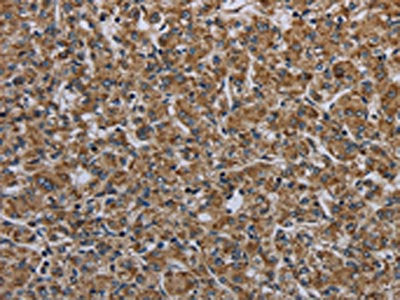 MYO7A Antibody