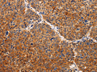 TIMP2 Antibody