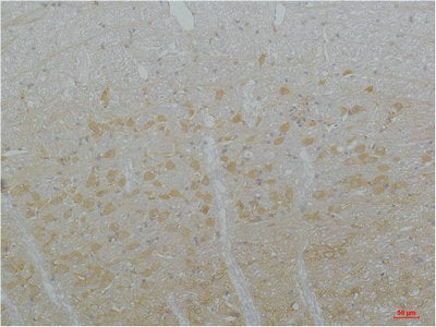 CACNA1I Antibody