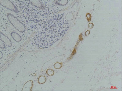 GRIK2 Antibody
