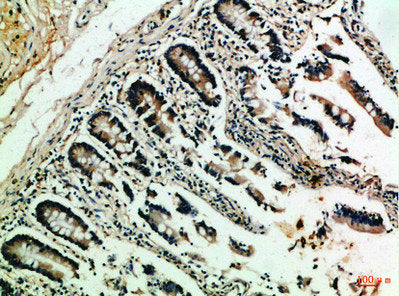 NFATC2 Antibody