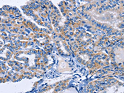 AMACR Antibody