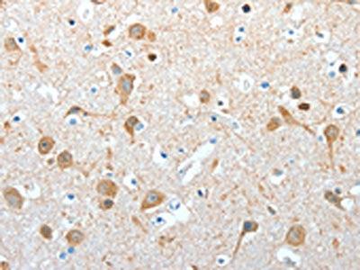 AKAP4 Antibody