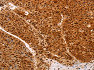 HEXIM1 Antibody