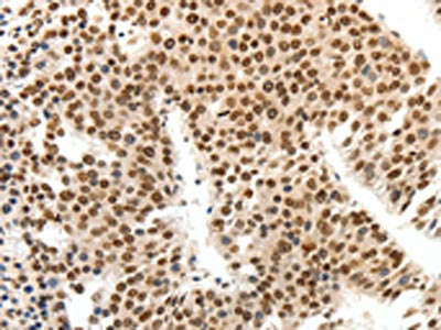 SIPA1 Antibody