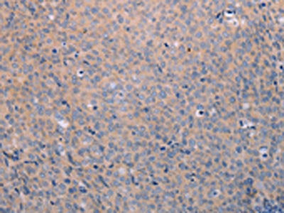 ANKRD26 Antibody