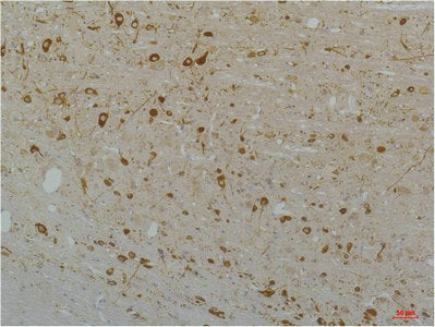 CACNA1D Antibody