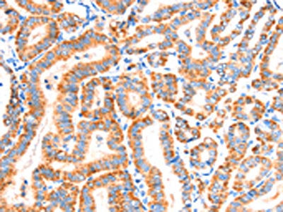 SCNN1A Antibody
