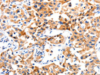 JAK2 Antibody