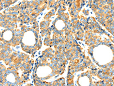 RIPK4 Antibody
