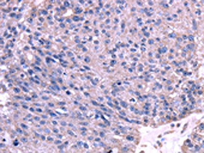 TRIM14 Antibody