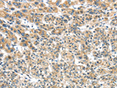 TRIM16 Antibody