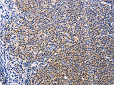 SYK Antibody