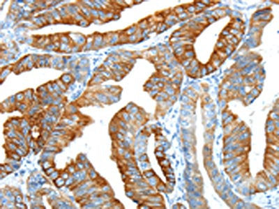 F2 Antibody