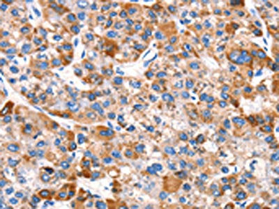 EPO Antibody
