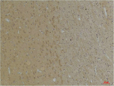 KCNK4 Antibody