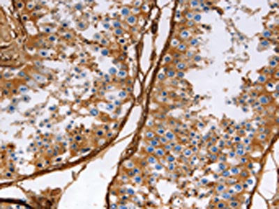 CALD1 Antibody