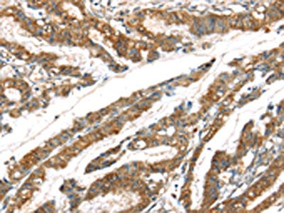GPD2 Antibody