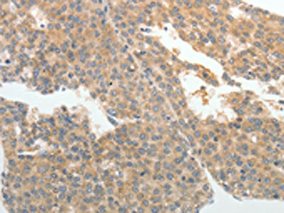 ABCB11 Antibody