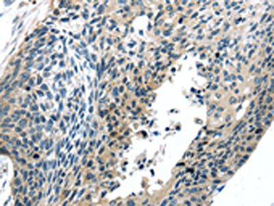BOK Antibody