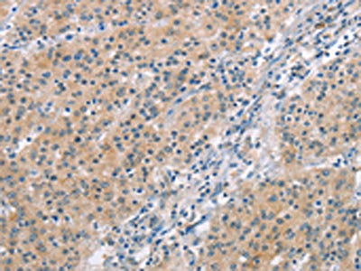 MCL1 Antibody