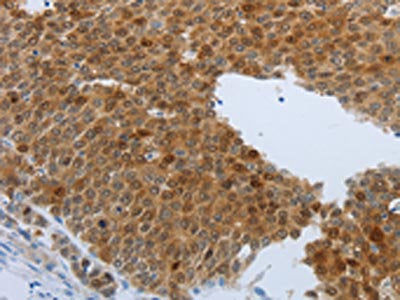 PTPRJ Antibody
