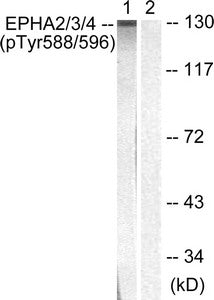 Phospho-EPHA2/EPHA3/EPHA4 (Tyr588/596) Antibody