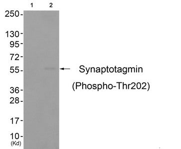 Phospho-SYT1 (Thr202) Antibody