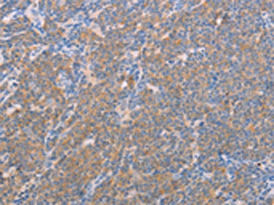 NFKBIE Antibody