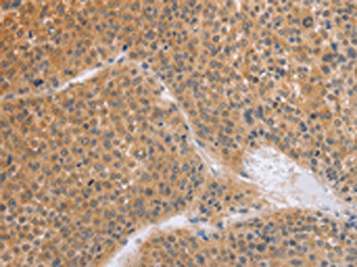 BRS3 Antibody
