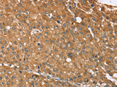 NOS2 Antibody