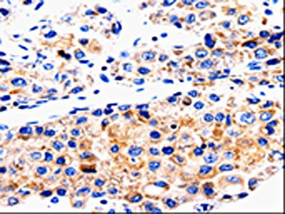 ABCG2 Antibody