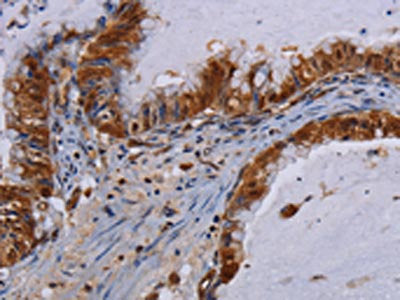 MECP2 Antibody