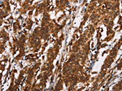 CTAG1A/CTAG1A Antibody