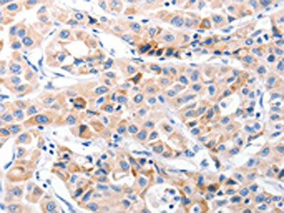 CDK7 Antibody