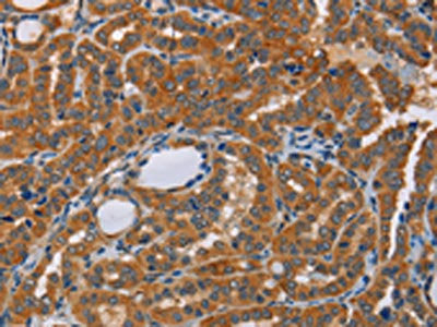 KRT13 Antibody