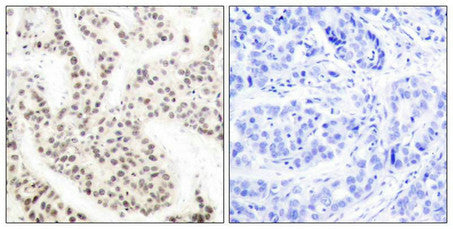 Phospho-ELK1 (Thr417) Antibody