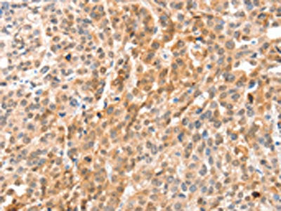 ANXA8 Antibody