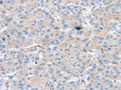 PTX3 Antibody