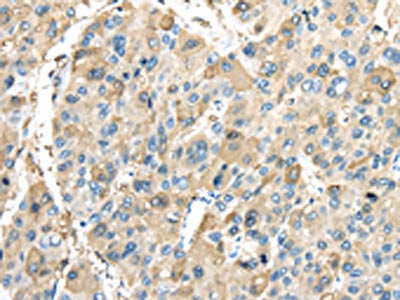 INHBB Antibody