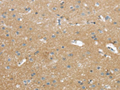 WASF2 Antibody