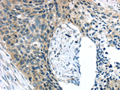 KIT Antibody