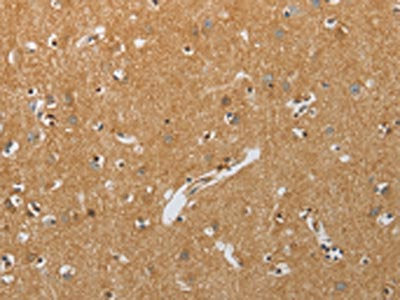 RHEB Antibody