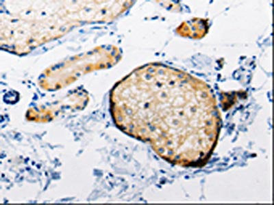 RAB6A Antibody