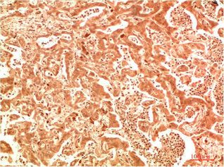 ATG7 Antibody