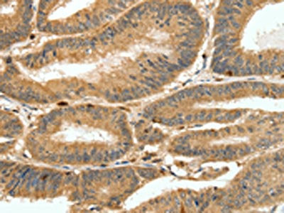 S100A4 Antibody